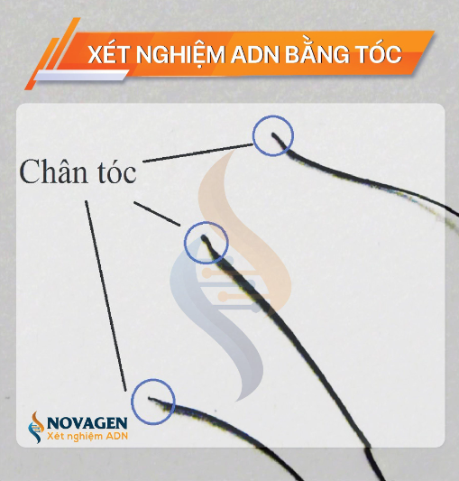 xet nghiem adn bang toc novagen