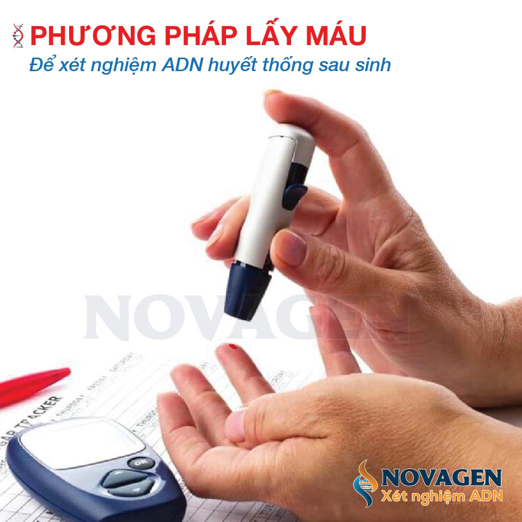 phuong-phap-lay-mau-xet-nghiem-adn