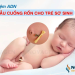 xet nghiem adn bang mau cuong ron co chinh xac khong