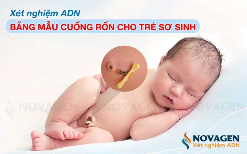 xet nghiem adn bang mau cuong ron co chinh xac khong