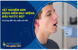 xet nghiem adn bang niem mac mieng nuoc bot