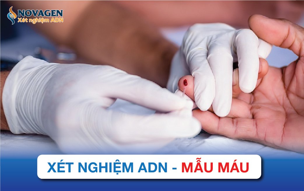 xet-nghiem-adn-mau-mau