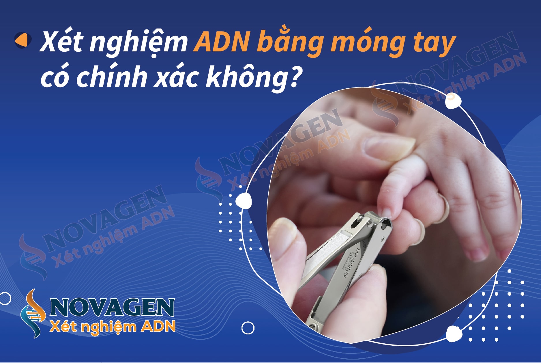 xet-nghiem-adn-mong-tay-co-chinh-xac-khong